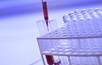 Science -lab _doping _Philippe Delavie _Pixabay